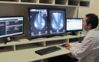 Cómo detectar un cáncer en una mujer con prótesis mamarias