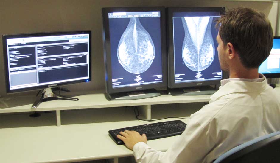 Mamografía Digital directa