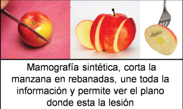 Mamografía sintética