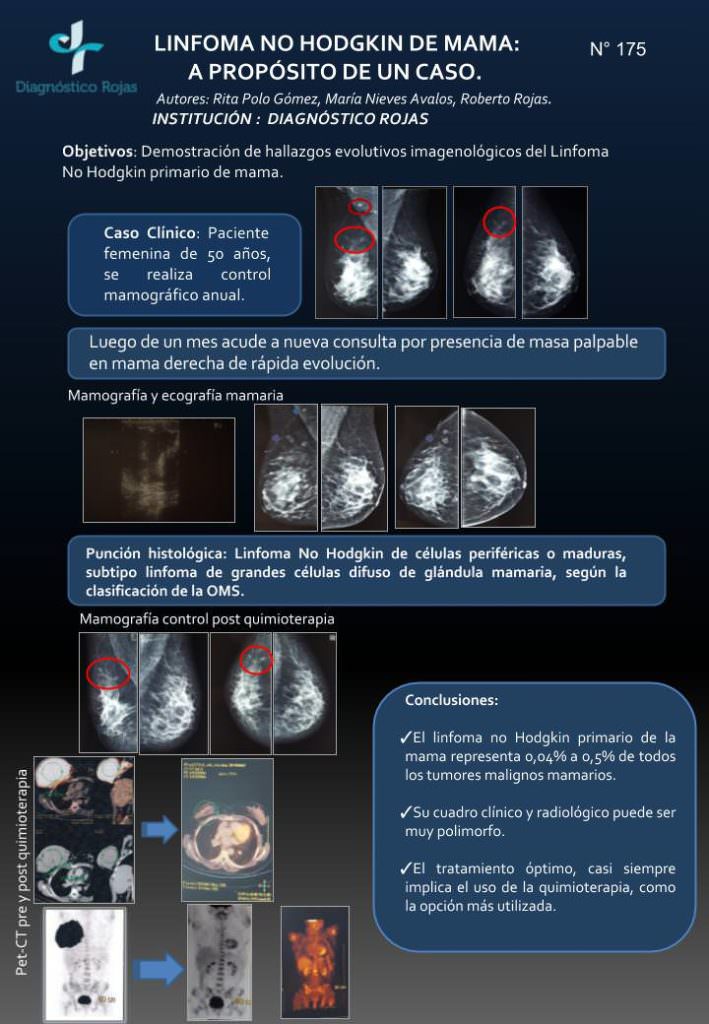 Caso Clínico LINFOMA NO HODGKIN DE MAMA