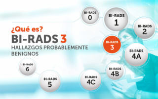 Birads 3