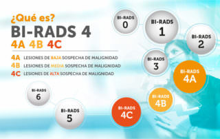 BI RADS 4 mamográfico