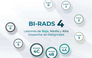 Infografía de Birads 4