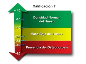Gráfico explicativo sobre cómo interpretar un T-Score y los rangos de valores normales en una densitometría ósea.