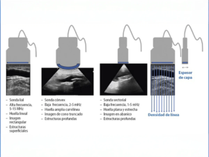 Infografía de cómo se hace un Eco Doppler