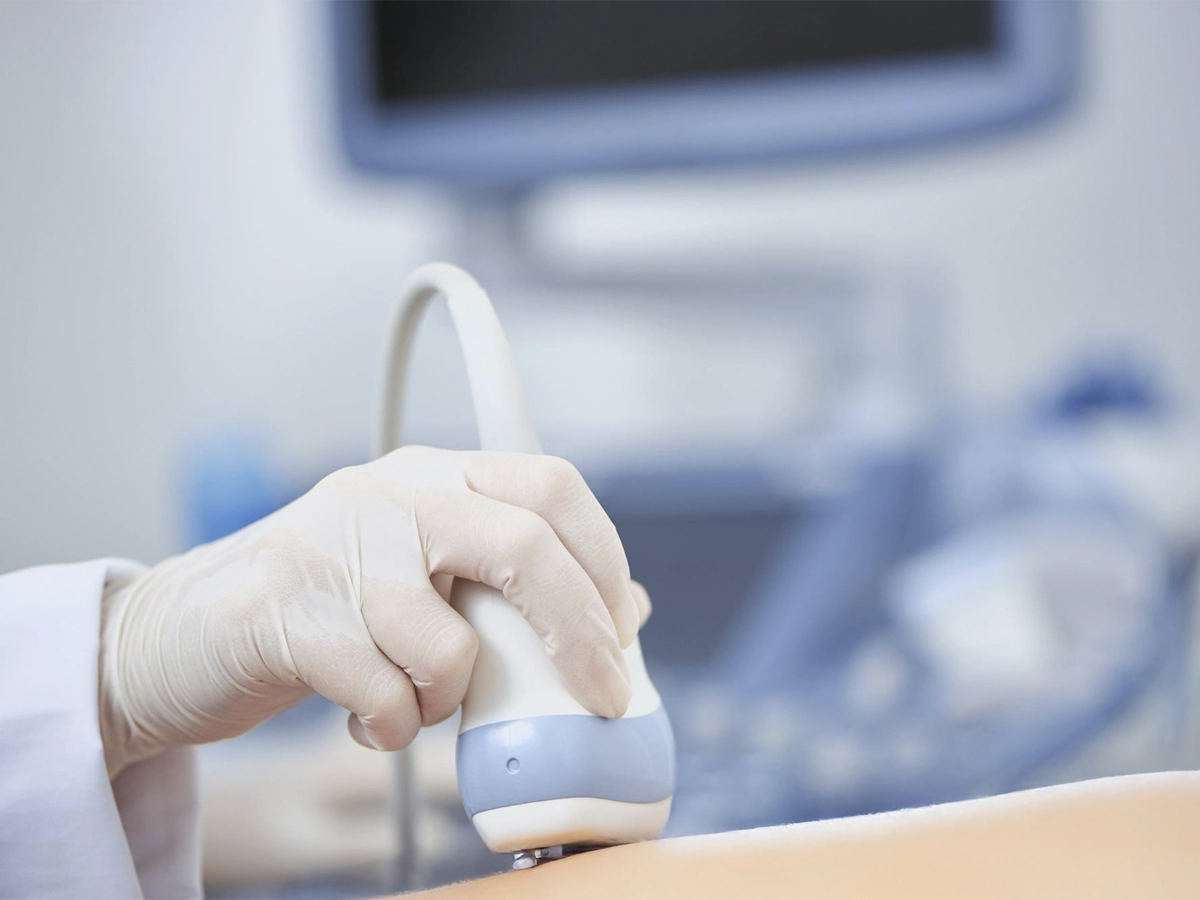 Doctor haciendo un Eco Doppler