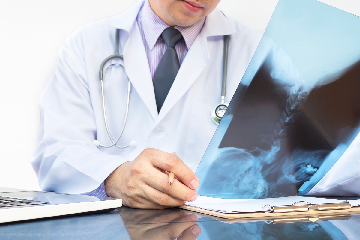 ¿Qué es la osteoporosis en la columna?