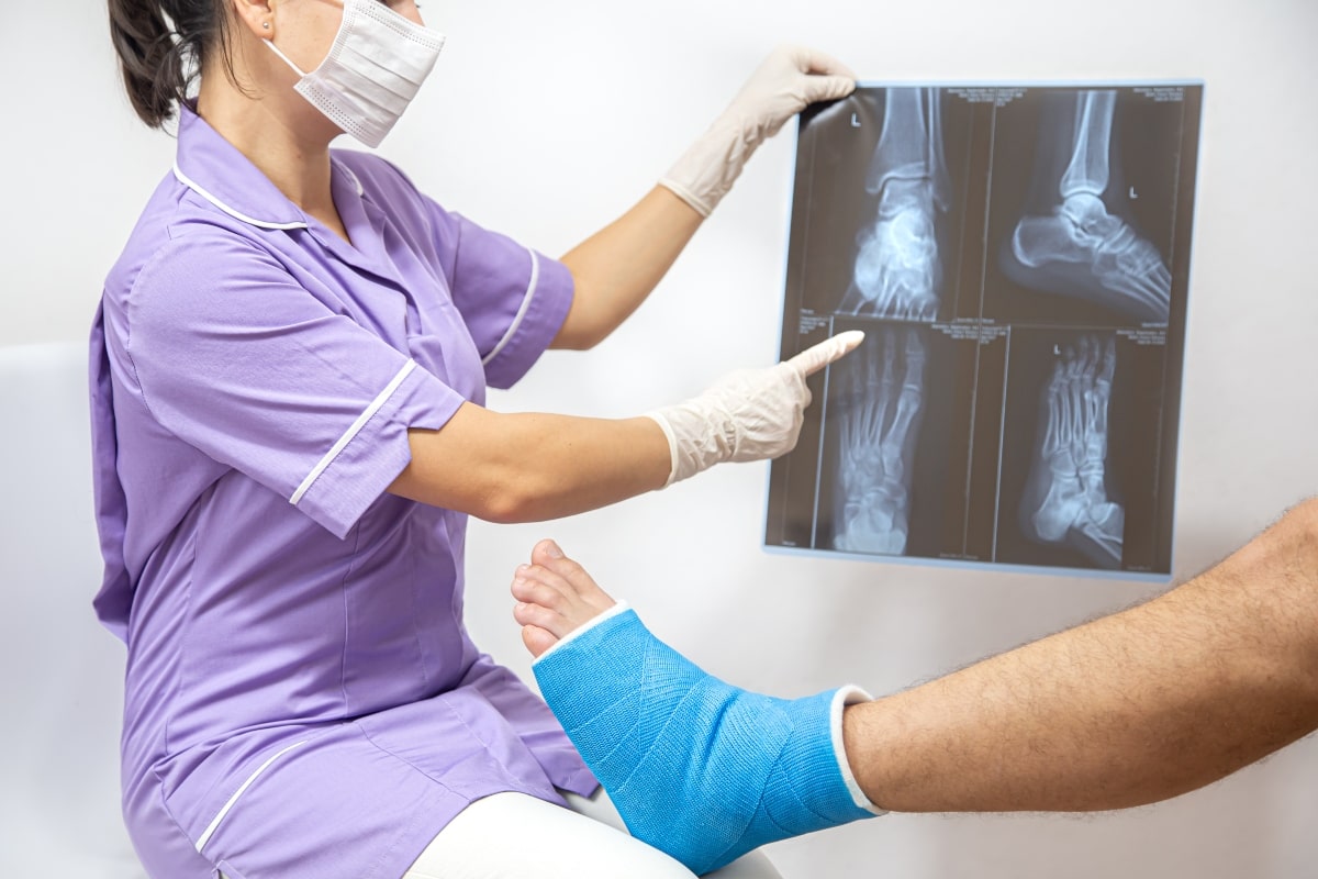 ¿Cómo prevenir fracturas en tus huesos?