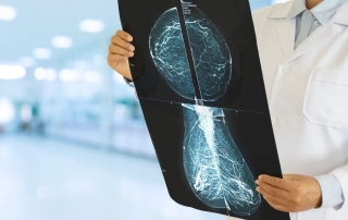 medica-analizando-mamografia