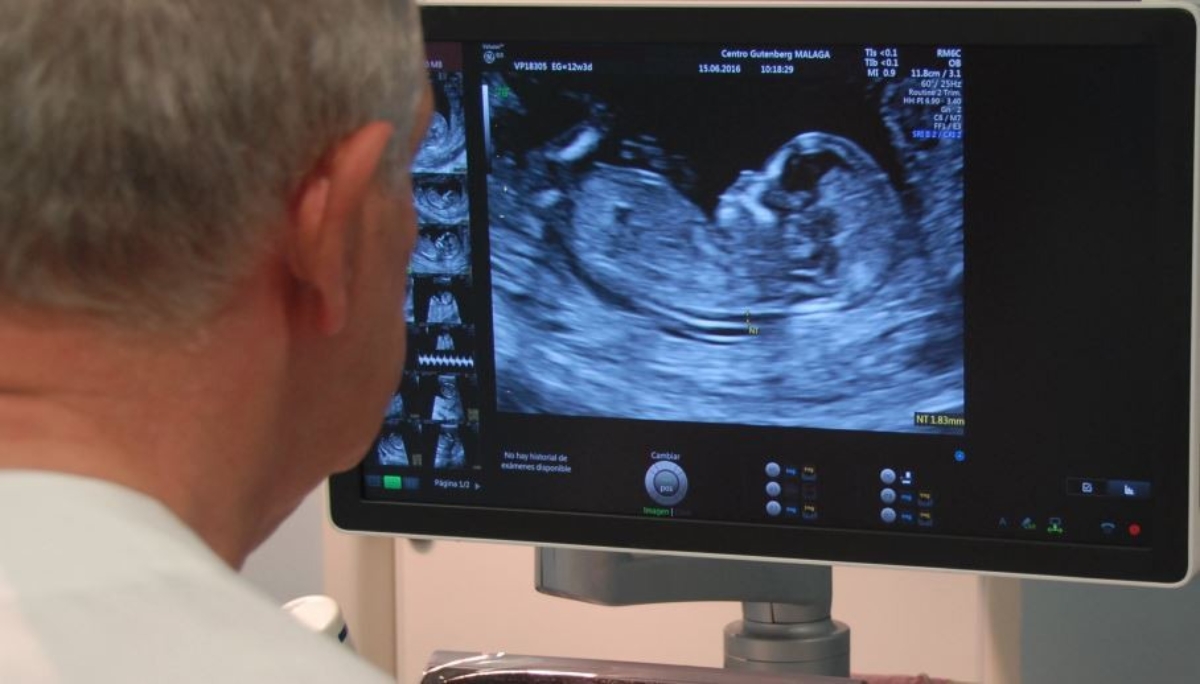 Examen doppler embarazo 2025