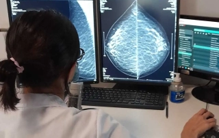 Doctora analizando una mamografía