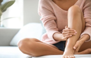 Varices en las piernas