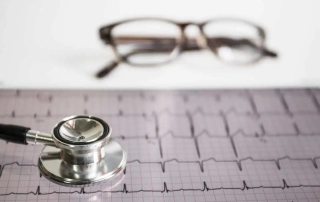 Imagen de un electrocardiograma