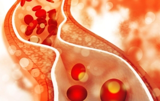 Enfermedad Vascular Periferica