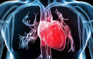 Cardiopatía Isquémica: Síntomas y Prevención