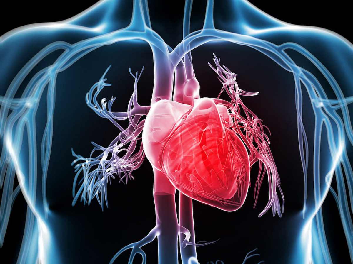 Cardiopatía Isquémica: Síntomas y Prevención