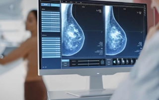 Mamografía con Contraste: ¿Qué es?