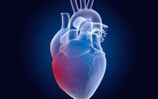 Endocarditis: Qué es y Por Qué Sucede