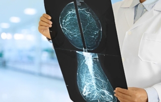 Carcinoma Ductal In Situ: Causas y Tratamientos