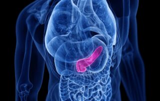Cáncer de Páncreas: Detección Temprana