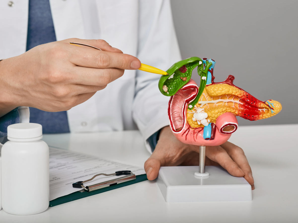 Cáncer de Vesícula Biliar: Detección Temprana