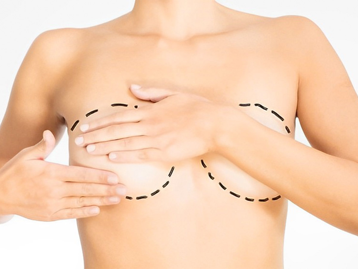Seroma