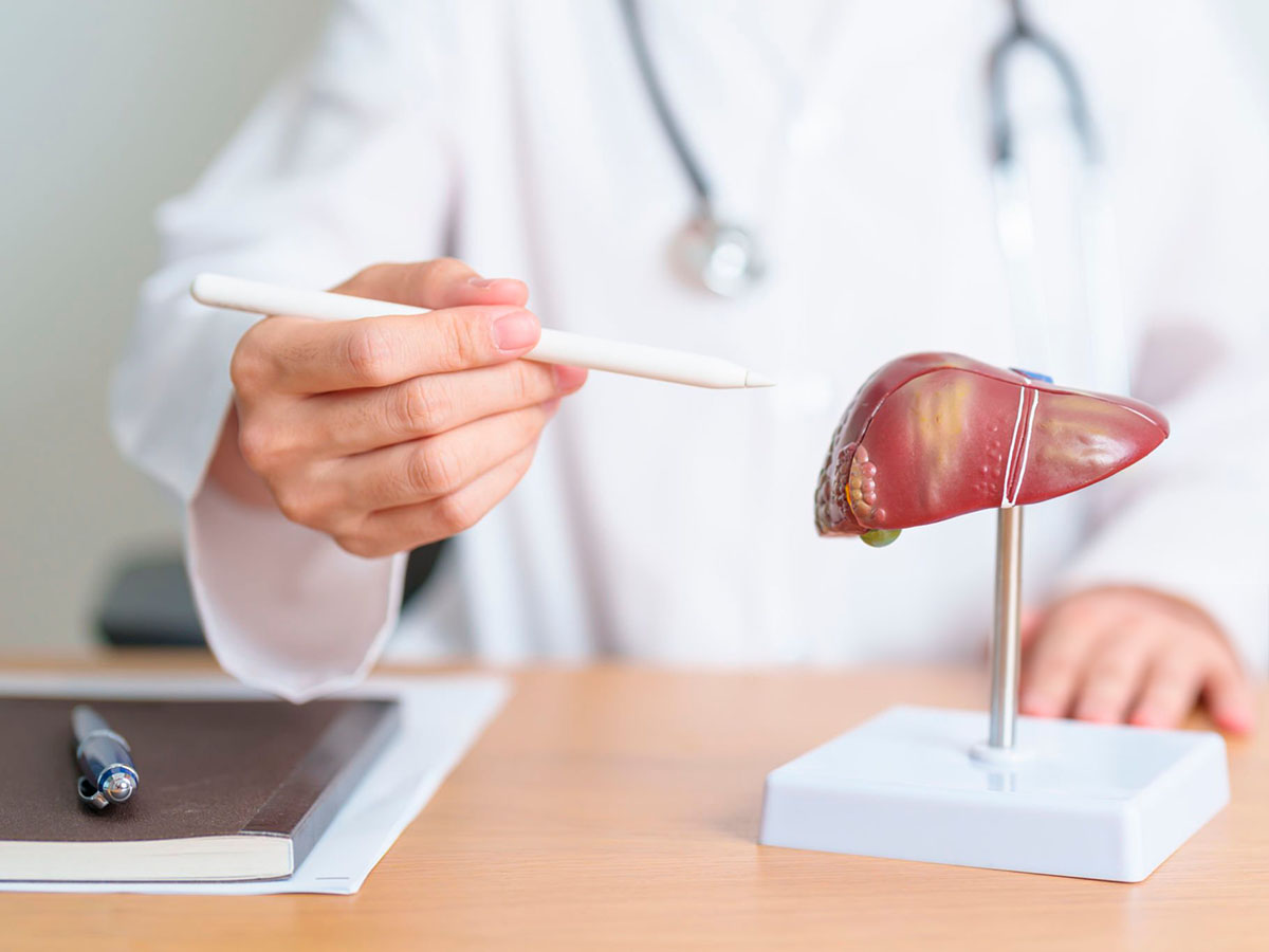 Médico mostrando las etapas de la cirrosis
