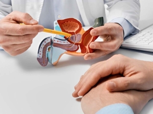 Médico enseñando un absceso de próstata