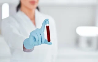 Una doctora con ambo médico y guantes muestra un tubo de recolección de muestras de sangre, asegurando un procedimiento de laboratorio preciso.