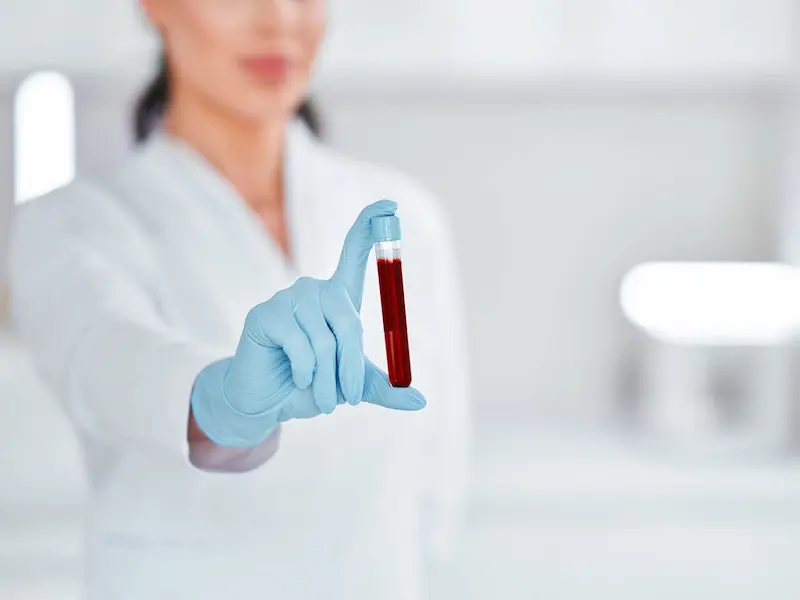 Una doctora con ambo médico y guantes muestra un tubo de recolección de muestras de sangre, asegurando un procedimiento de laboratorio preciso.