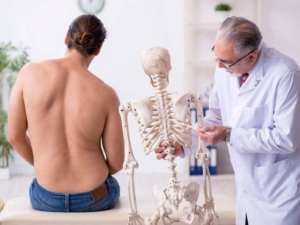 Médico explicando a qué se debe la escoliosis