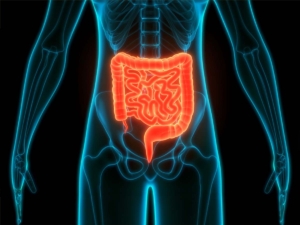 Imagen de una obstrucción intestinal 