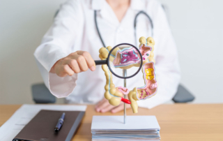 Cáncer colorrectal