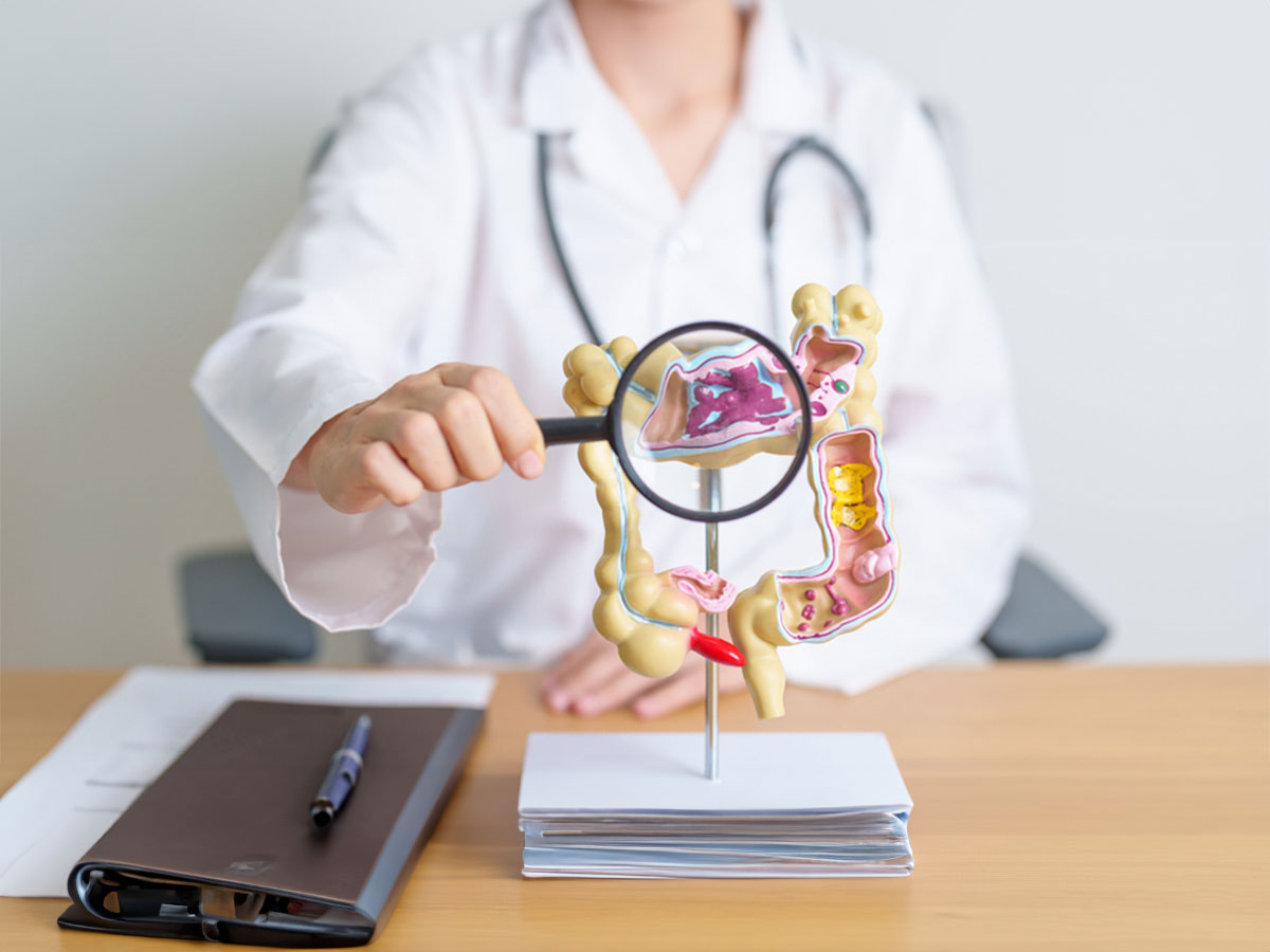 Cáncer colorrectal