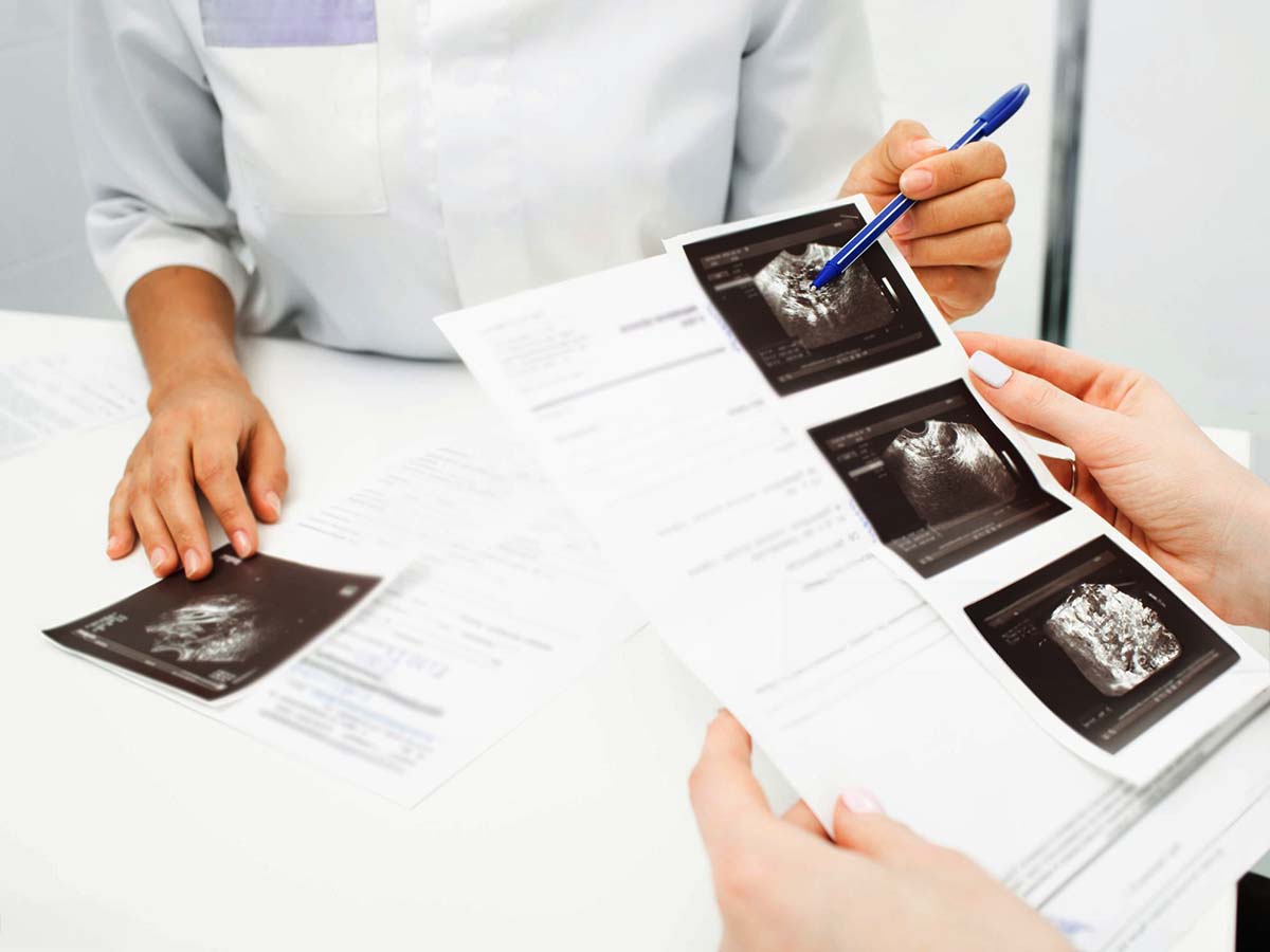 Ecografía Fetal