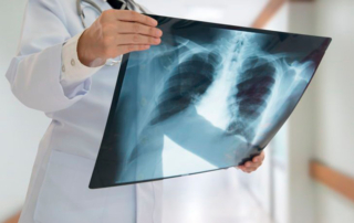 Qué enfermedades detecta una radiografía