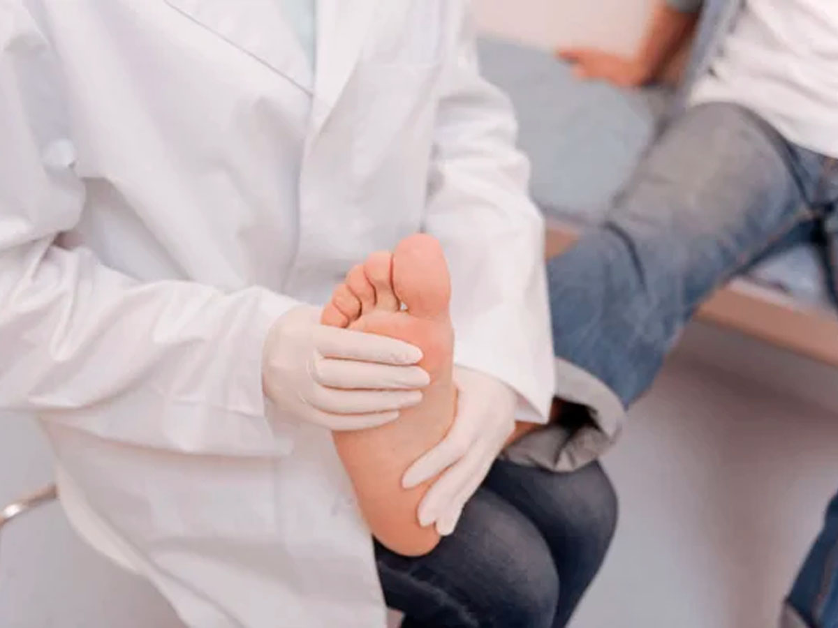 Doctor revisando el pie de un paciente con síntomas de gota