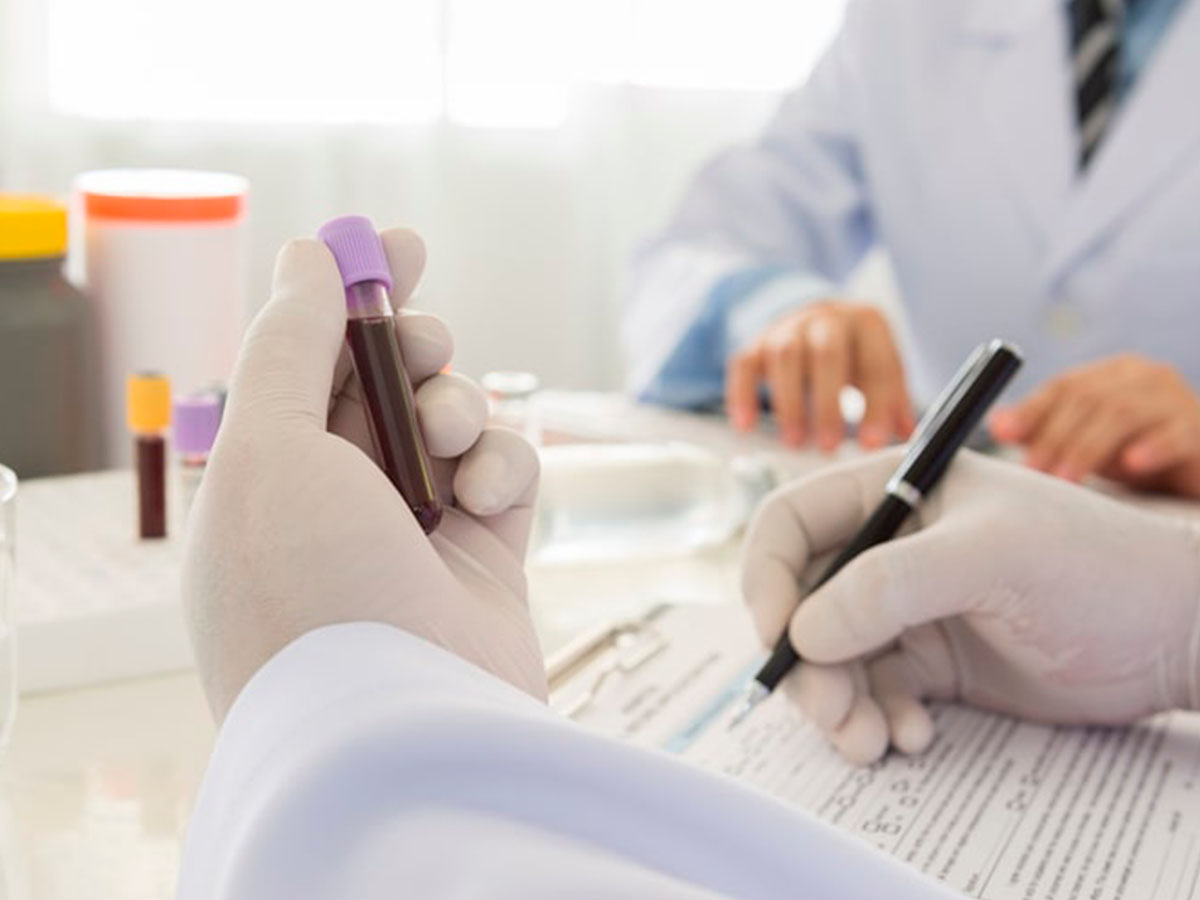 Anemia Aplásica