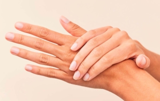 Manos de mujer con hongos en las uñas