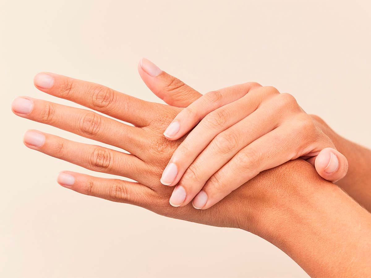 Manos de mujer con hongos en las uñas