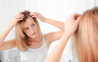 Mujer con síntomas de alopecia