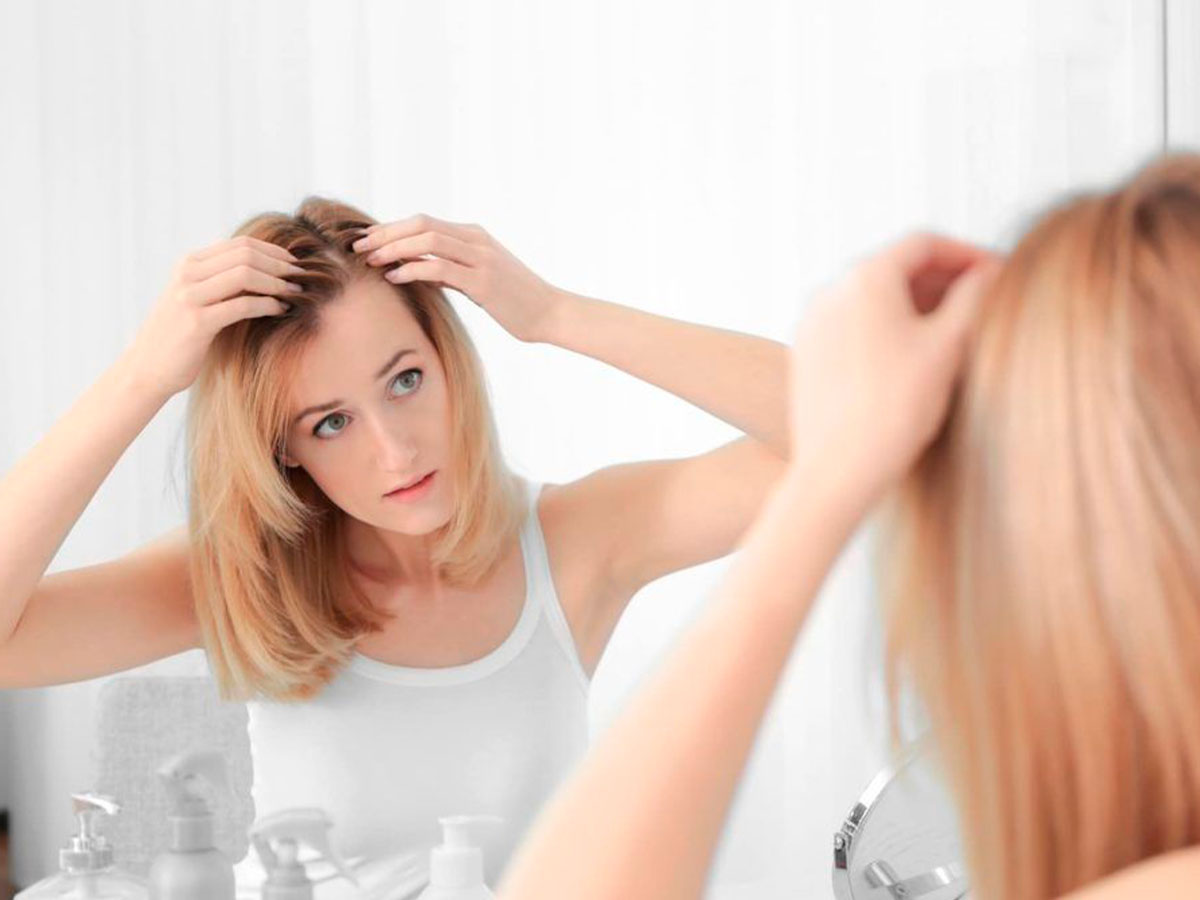 Mujer con síntomas de alopecia