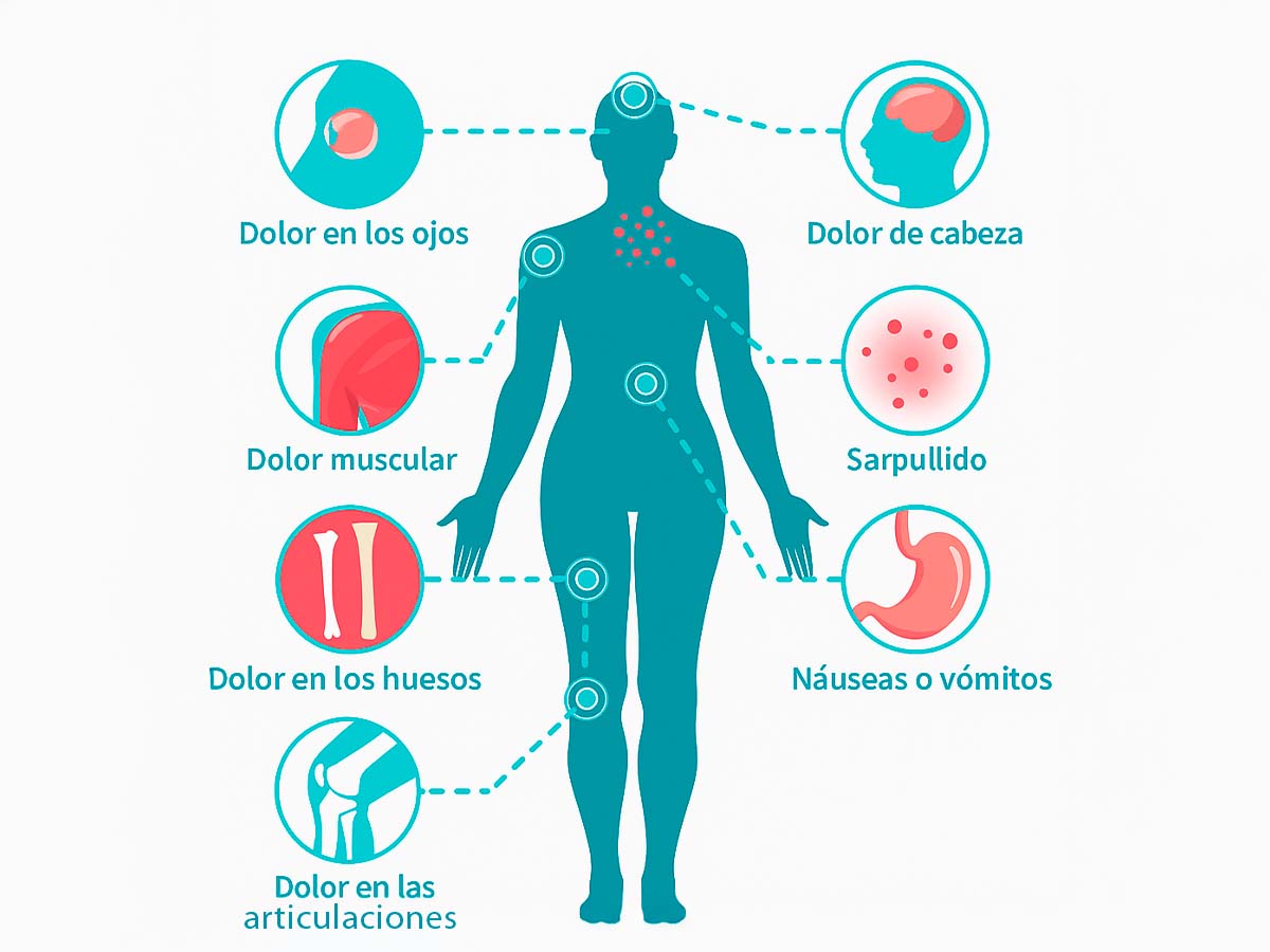 Síntomas del Dengue Solicitá un turno en Diagnóstico Rojas