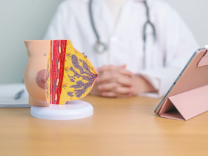 Doctor explicando qué es un absceso mamario