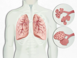 Comparación visual de amígdalas normales y amígdalas inflamadas