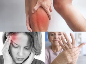 Ilustración de zonas de dolor donde se deben conocer los riesgos de la crioterapia y cómo evitar quemaduras en la piel.