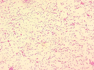 Brucelosis en humanos 