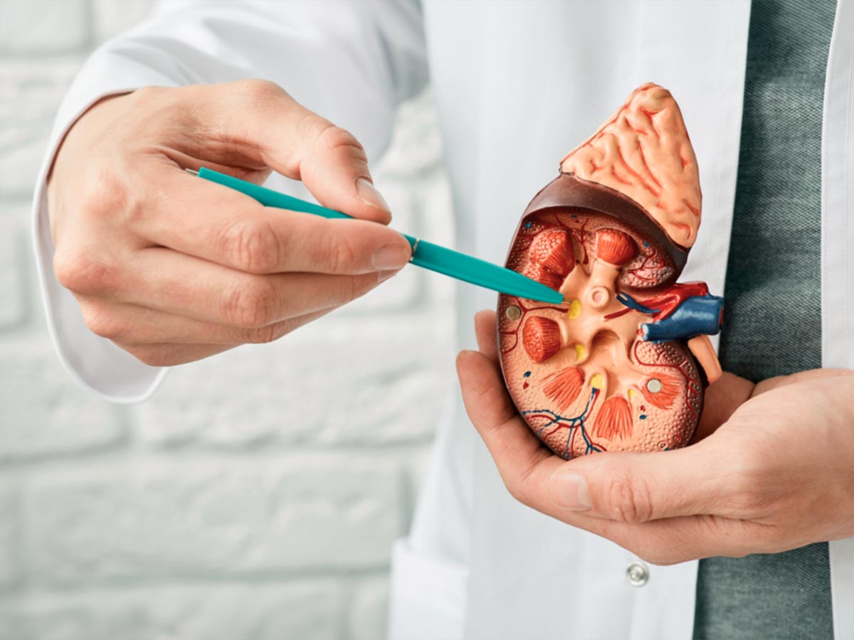 ¿Qué es la hidronefrosis?