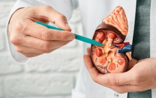 Médico mostrando un ejemplo de hidronefrosis en riñon